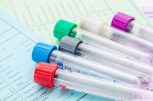 Methylation Markers blood test